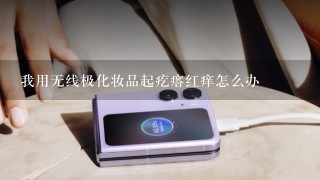 我用无线极化妆品起疙瘩红痒怎么办